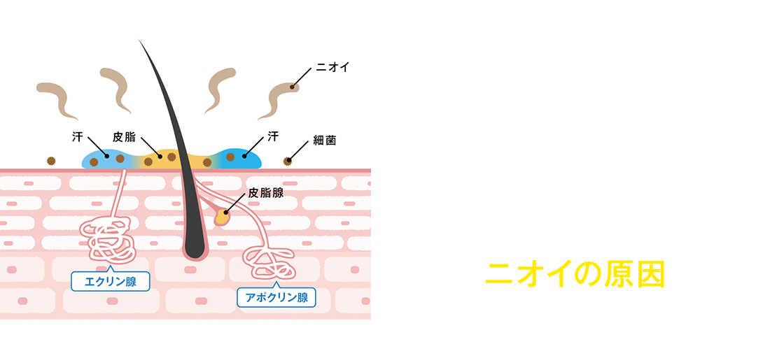 これらがニオイの原因